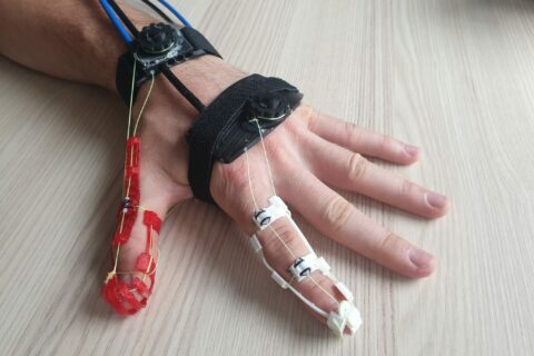 Towards entry "Restoring hand function with intelligent neuro-orthoses"